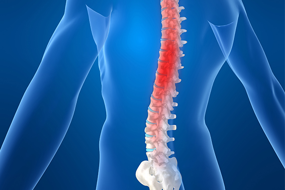 Why is physiotherapy so important for slipped disc recovery