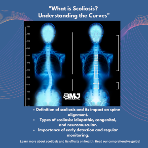A poster of normal and abnormal spine with condition known as Scolosis